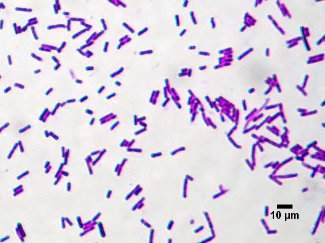 loi-khuan-bao-tu-bacillus